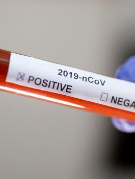 فحوصات كورونا 