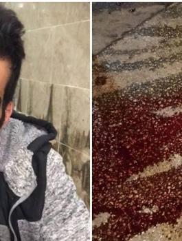 شهيد في طولكرم برصاص الاحتلال 