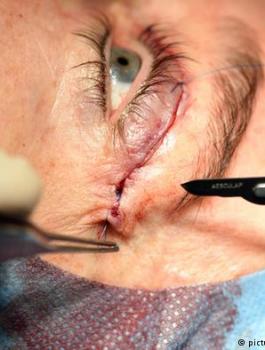 علاج جديد للعمى 