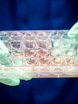 وفيات كورونا والذكورة 