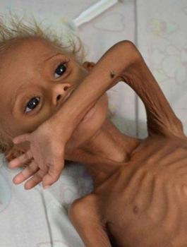 الاطفال في اليمن 