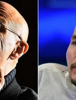 طبيب بريطاني: زراعة الرأس لم تنجح وربما لن تنجح على الإطلاق