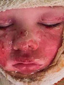 مقتل طفل بالماء المغلي في سنغافورة 