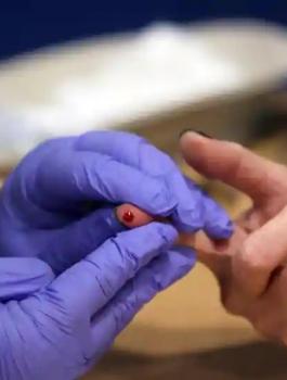 الاصابات بفيروس كورونا في اسرائيل 