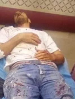 التقاط