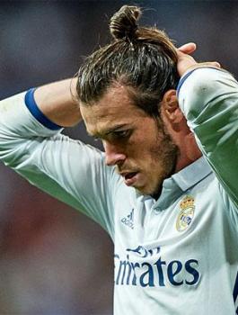 اصابة جاريث بيل 