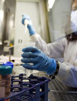 اصابات بالكورونا في القدس 