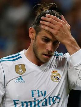 الاصابات تلاحق ريال مدريد 