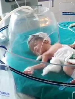 كلاب ضالة تنقذ رضيعة 