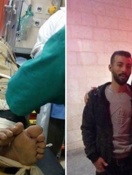 انقاذ سيدة علقت داخل حفرة امتصاص 