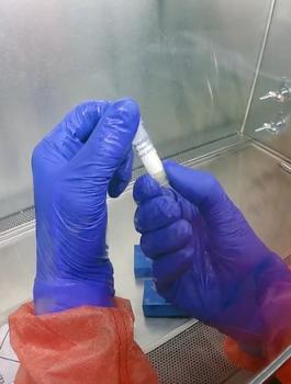 اصابات بفيروس كورونا في رام الله 