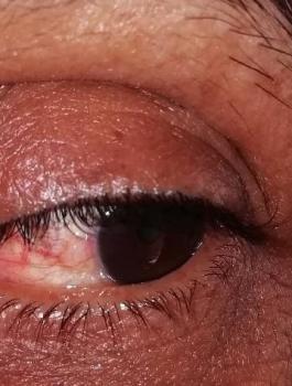 رجل يقتلع عيني زوجته في الاردن 