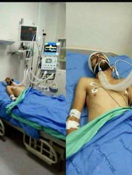 استشهاد شاب من حزما متأثراً بجروح أصيب بها قبل 3 أيام