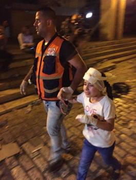 إصابات خلال قمع الاحتلال للمصلين في باب الأسباط