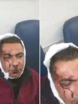 تعرض مقدسي لمحاولة قتل من قبل مستوطنين 