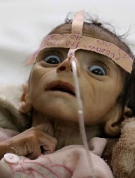 الامراض في اليمن 