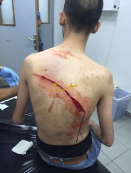 الاعتداء على محامي اردني من قبل اسرائيليين في عمان 