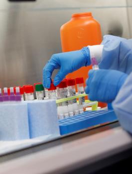 اصابات بفيروس كورونا في غزة 