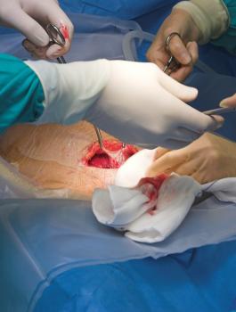 وفاة دينا الحايك في عملية قيصرية 