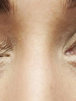 اسباب رعشة العين 