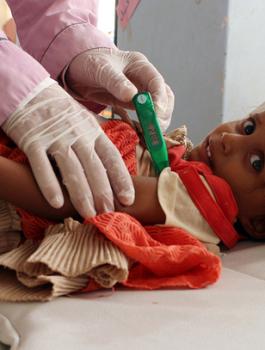 الكوليرا في اليمن 