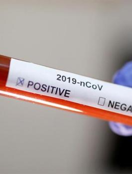 580