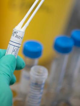 اصابات بالكورونا في فلسطين 