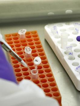 انفلونزا الخنازير في الاردن 