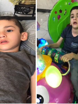 مرض تيم النادر 