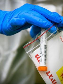 اصابات بفيروس كورونا في القدس 