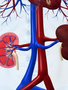 الكلية والمصفاة 