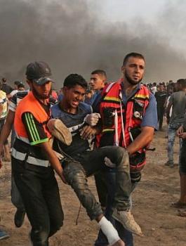 اصابة فلسطينيين بجراح في مسيرات العودة 