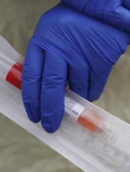 وفاة شاب عشريني متأثرا باصابته بفيروس كورونا 