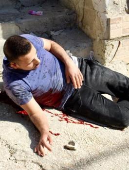 الشهيد عمر البدوي 