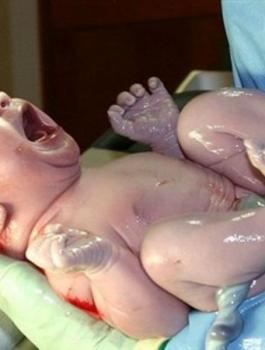 اطفال القيصرية