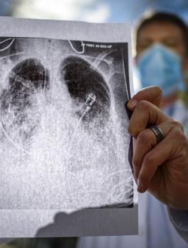 وفيات بكورونا في مناطق السلطة