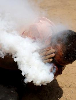 اصابة شاب بقنبلة غاز في وجهه بجنين