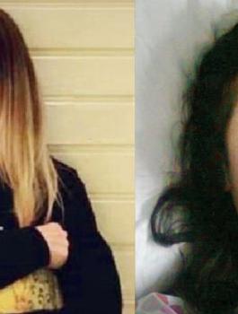 بتر ساقي فتاة بعد عملية انف