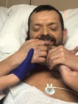 اجراء عملية زراعة كتف وذراعين