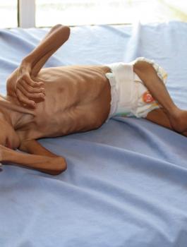 الامم المتحدة واليمن