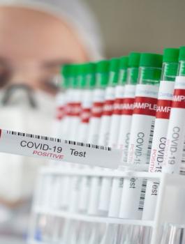 الوفيات والاصابات بكورونا في الاردن