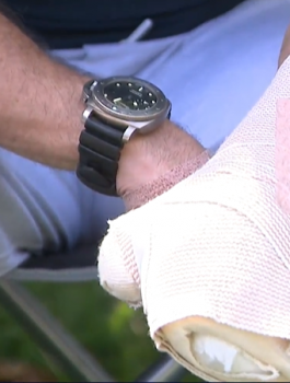 بتر اصابع شرق اريحا