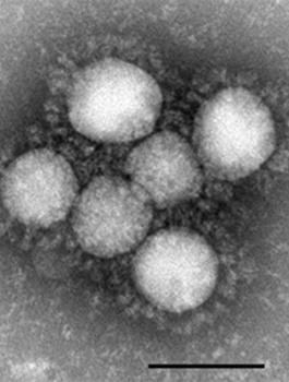 الرئة والصدرية وفيروس كورونا