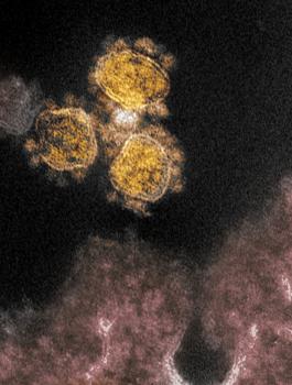 اكتشاف سلالة جديدة من فيروس كورونا