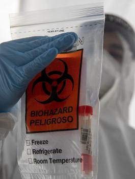 الاصابات بفيروس كورونا في القدس