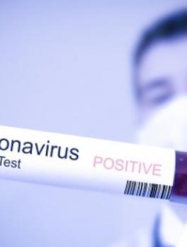 coronavirus-cdc.jpg