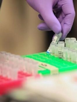 الوفيات والاصابات بكورونا في العالم