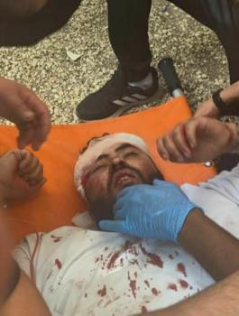 الاصابات في المسجد الاقصى