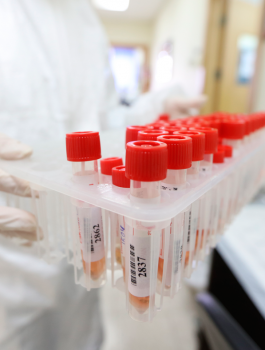 الاصابات والوفيات بكورونا في العالم