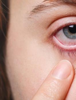 الفطر الاسود